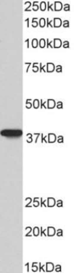 AIM2 Antibody (10M2B3) - Azide and BSA Free, Novus Biologicals 0.1 mg;